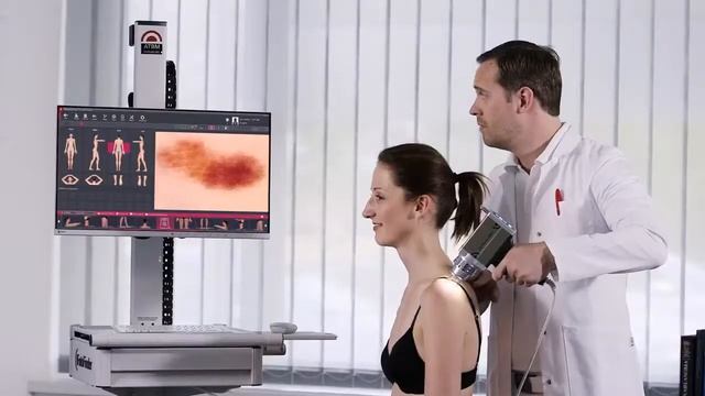 Mole | Check | Mapping | Removal | Skin Cancer Detection @ Specialist Skin Clinic Cardiff Wales смотреть онлайн