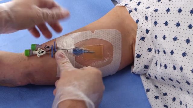 Tegaderm™ CHG (1658) - Application for PICC Video смотреть онлайн
