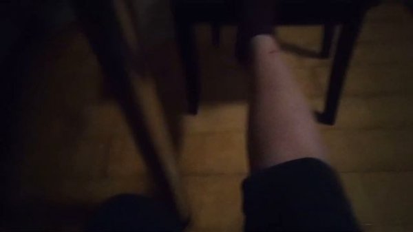 Укус комара!