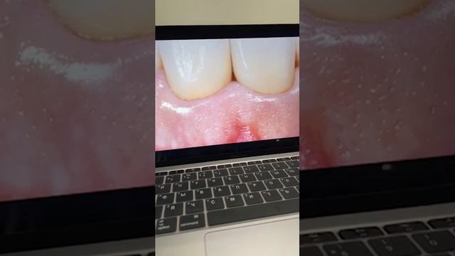 Ортопедия, life смотреть онлайн