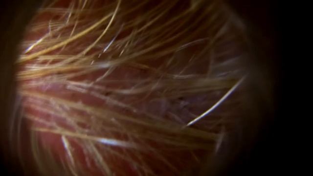 40x zoom on canine mange смотреть онлайн