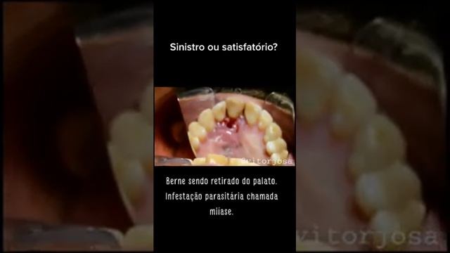 RETIRANDO BERNES смотреть онлайн