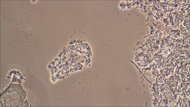 Killing Bacteria Naturally with Salt смотреть онлайн