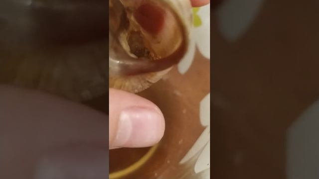 Пытаюсь лечить улитку смотреть онлайн