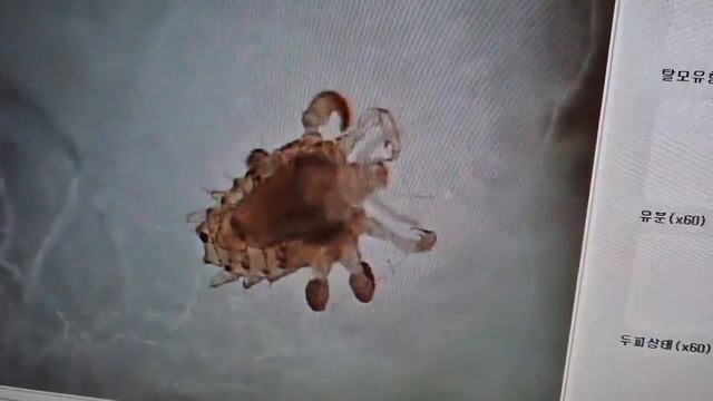 사면발이(사면발니) 동영상 Pubic Louse Video - 메어리벳의원 정종영 смотреть онлайн