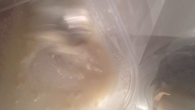 Post op Tummy tuck 16 weeks update plus scar therapy!!! смотреть онлайн