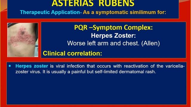 28 Part 4 Asterias Rubens Clinical Correlation смотреть онлайн