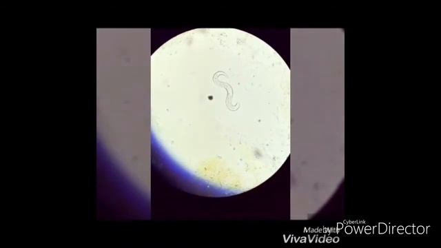 strongyloides stercoralis larva смотреть онлайн