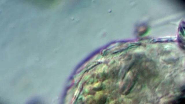 MACROTRACHELA PAPILLOSA смотреть онлайн