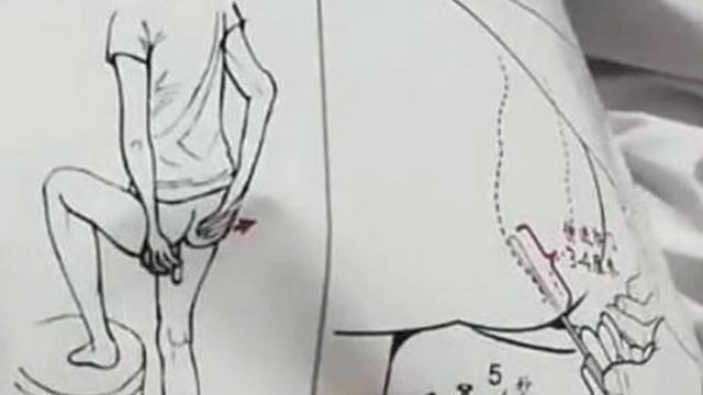 Anal Swab Test For Covid19 ?