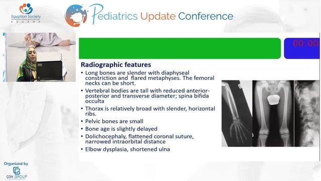 Prof. Ghada Anwar/ Syndromic short stature смотреть онлайн