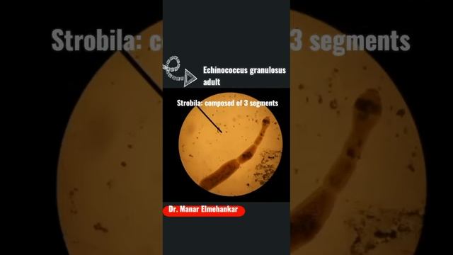 Helminthology|Echinococcus granulosus adult- Dr. Manar Elmehankar #Practical_Parasitology_slides смотреть онлайн