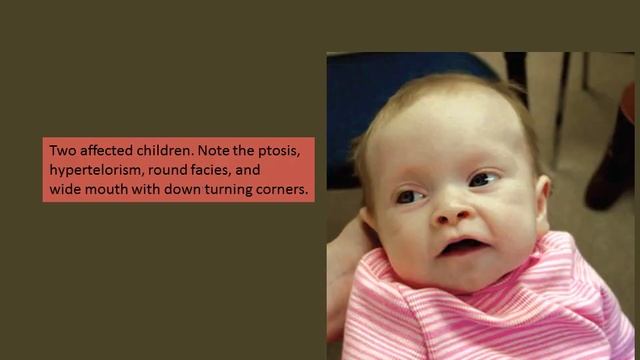 DELETION 18P SYNDROME 18P SYNDROME) смотреть онлайн