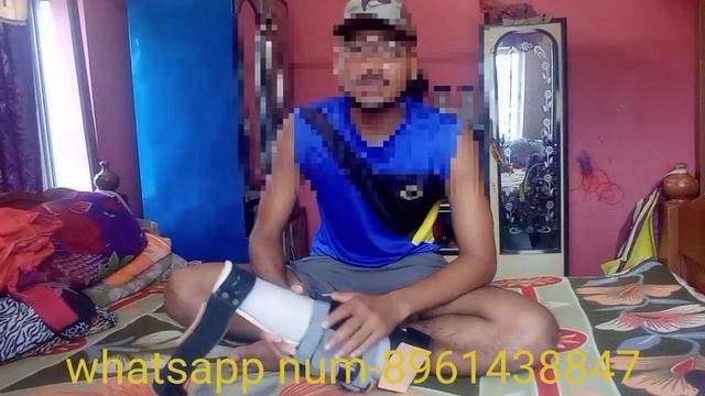ssc gd medical carrying angle problem || carrying angle kaise tik kre full information || смотреть онлайн