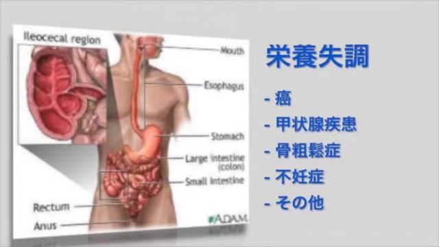KOBAYA смотреть онлайн
