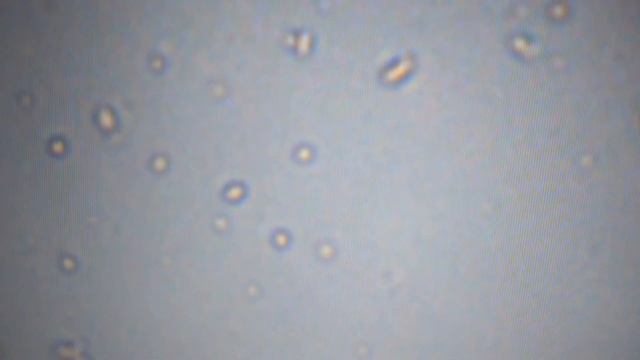 World of Microsporidia смотреть онлайн
