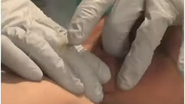Neonatal Assessment Pregnancy, Labor, Delivery смотреть онлайн