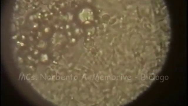 Lutzomyia whitmani infectado com Leishmania смотреть онлайн
