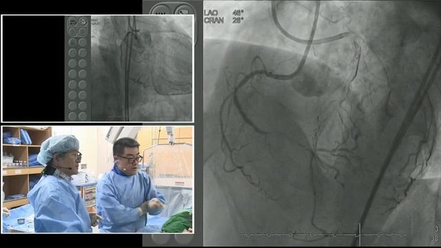 [TCTAP 2018] Master the CTO - Live Case Session III смотреть онлайн