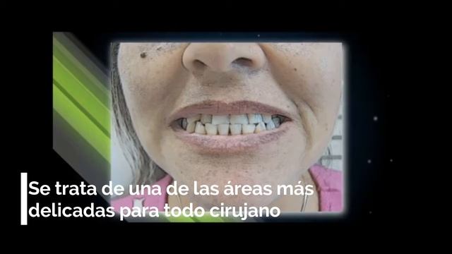 ¿ DÓNDE PUEDES ESTUDIAR CIRUGÍA MAXILOFACIAL EN RUSIA? | Rusia | Como estudiar medicina en Rusia смотреть онлайн