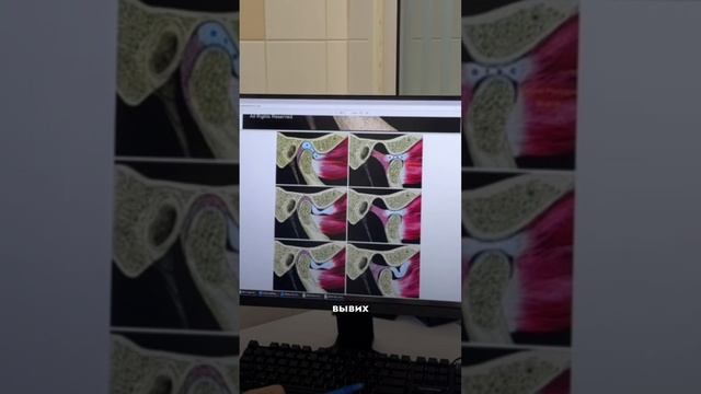 КАК РАБОТАЕТ ВНЧС? смотреть онлайн