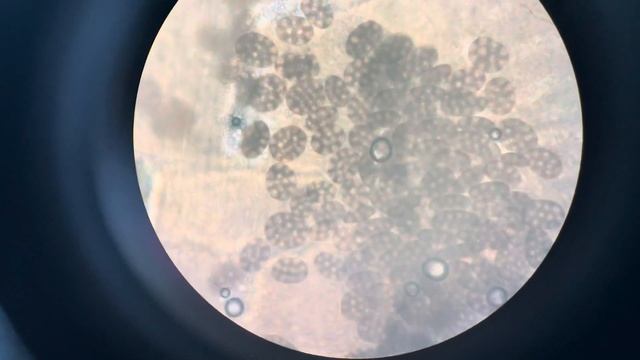 Dipylidium caninum смотреть онлайн