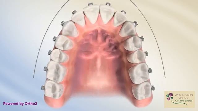 Damon Arch Form смотреть онлайн
