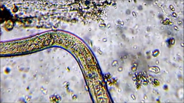 STRONGYLOIDES STERCORALIS VISTO NEL DETTAGLIO смотреть онлайн