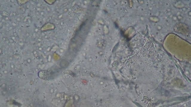 Larva de Strongyloides ativa JF смотреть онлайн