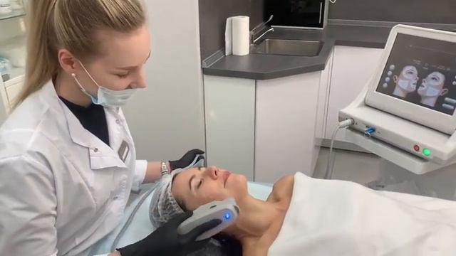 Ультразвуковой лифтинг лица аппаратом Hifu