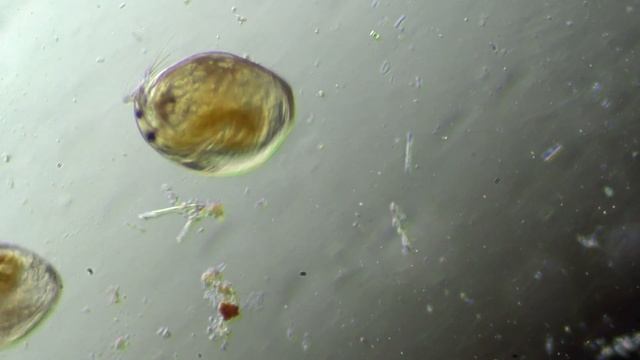 Daphnia pulex under the Microscope смотреть онлайн