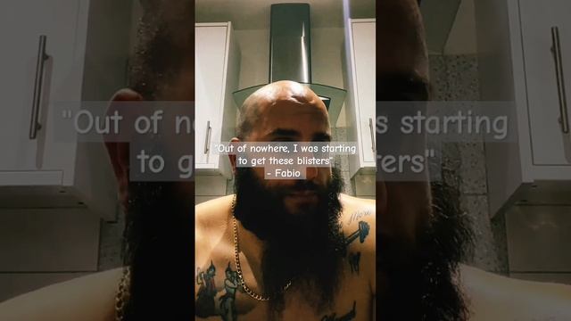 It Feels Like Razors - Vol. 59: "She Was Giving Me Oral Sex" смотреть онлайн
