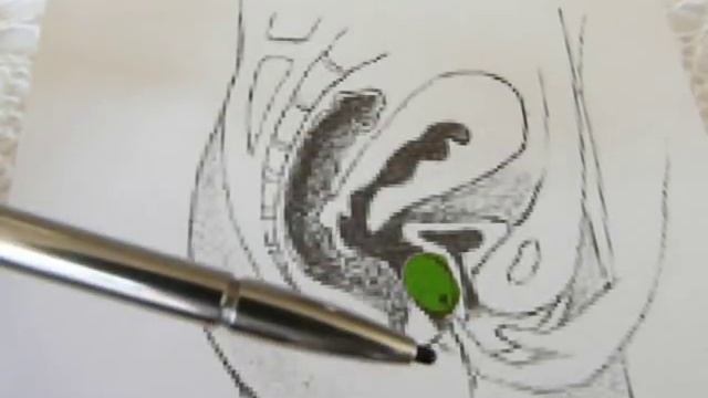 Jade Ben Wa Balls And Jade Eggs For Kegel Exercise