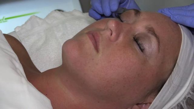 Bellissimo Medi Spa: Most Popular Procedures смотреть онлайн