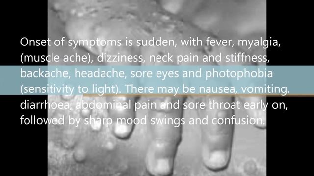 What is Congo Virus, Symptoms, Prevention and Treatment смотреть онлайн