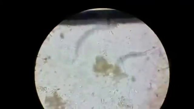 Strongyloides Stercoralis em lâmina feita com salina. смотреть онлайн