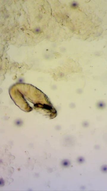 Koi Parasite Skin Flukes Under Microscope, What to look for, REALLY close UP!! #Shorts смотреть онлайн