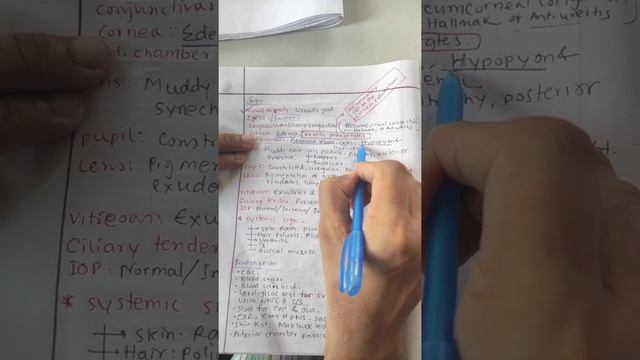 Uveal tract part 1 смотреть онлайн