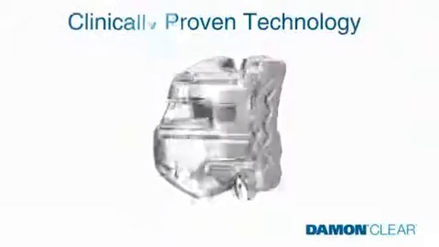 Damon Clear Braces from Bhandal Dental Coventry. смотреть онлайн