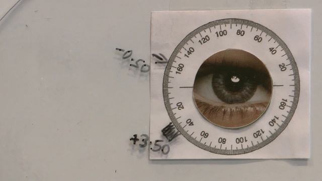 Cross Cyl Refraction Part 2: Subjective Refraction Part 8 смотреть онлайн