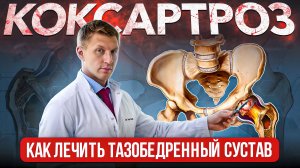 ЛЕЧЕНИЕ КОКСАРТРОЗА | Доктор Еремин Иван Константинович