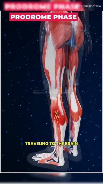 Why Rabies is Terrifying смотреть онлайн