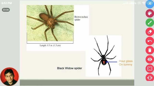 Parasitology practical examination 2nd year MBBS spots BY DR.VISHWA COACHING WHATSAPP +919930788955 смотреть онлайн