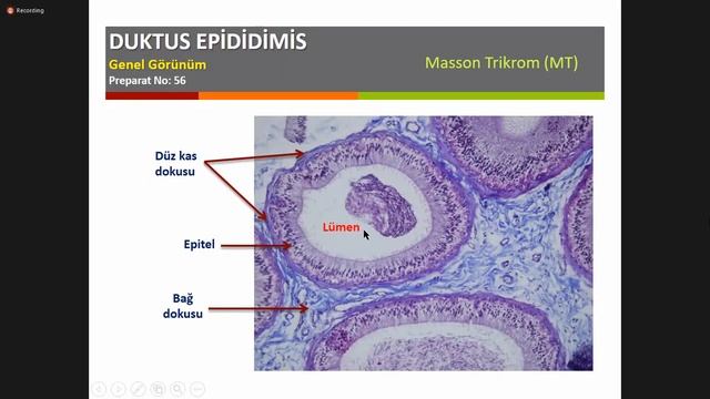 Histoloji 3 Pratik - Testis, Duktus Epididimis, Duktus Deferens, Prostat смотреть онлайн