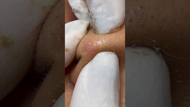 Satisfying video with Chung Vo Spa #101 смотреть онлайн