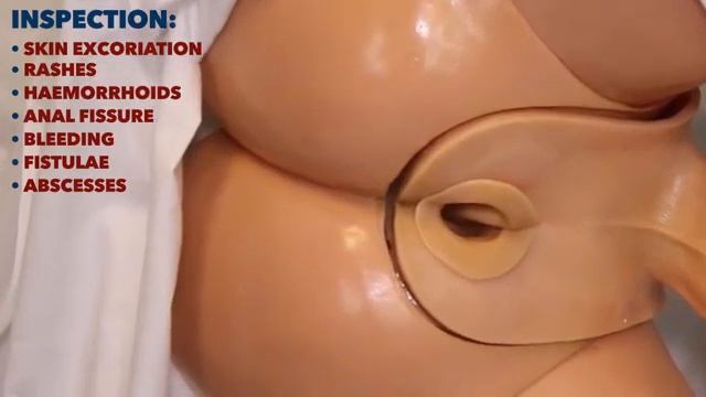 G54 || CLINICAL SURGICAL SKILLS 4 || Rectal Examination PR OSCE Guide смотреть онлайн