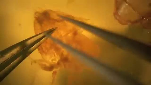 Dissection Of The Female Genitalia Of The Cactus Moth, Cactoblastis Cactorum