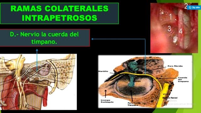 Par craneal VII facial Ruth Pacha Acarapi, UDABOL Cochabamba смотреть онлайн