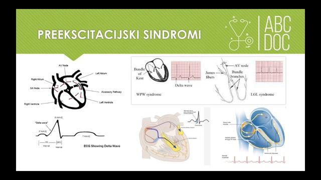 INTERPRETACIJA EKG SNIMKA 2. dio смотреть онлайн