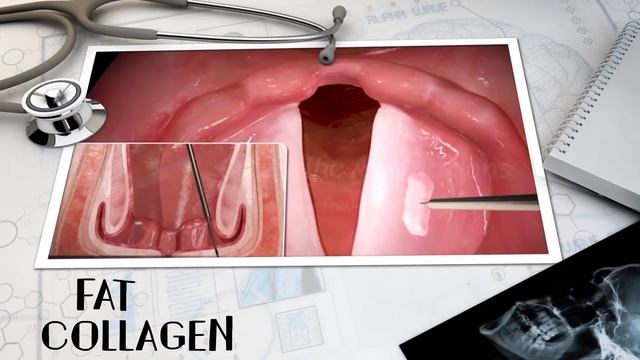 विचित्र SURGERIES जो लड़कियाँ सुंदरता बढ़ाने के लिए करतीं है | Unusual Cosmetic Procedures смотреть онлайн